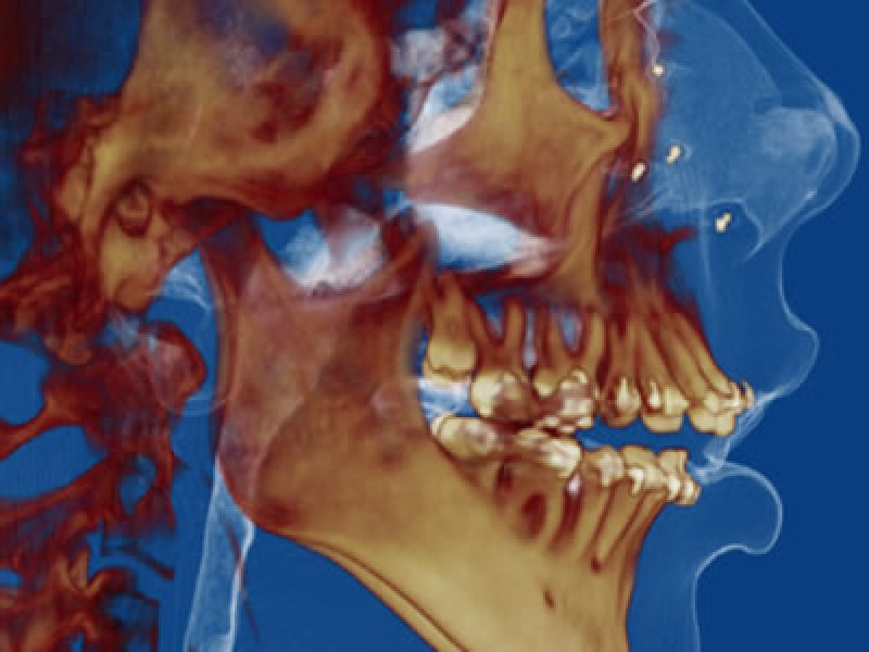 Cirugía maxilofacial